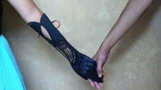 Stylish 3D-Printed Prosthetic Arm